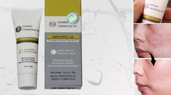 Gamma chemicals PTE - Điều trị mụn trứng cá, ngừa thâm, sẹo do mụn để lại