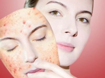 Fresh White Sand - Làm sạch sâu, loại bỏ tất cả các bụi bẩn, bã nhờn