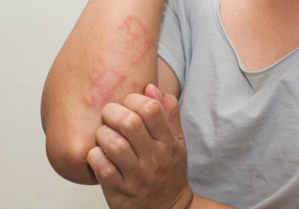 Curaflu Nighttime - Hỗ trợ làm giảm triệu chứng của dị ứng theo mùa