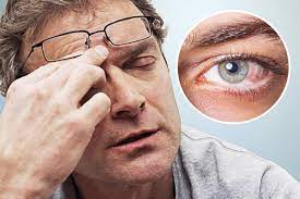 mỏi mắt kho mắt giải pháp diều trị 
